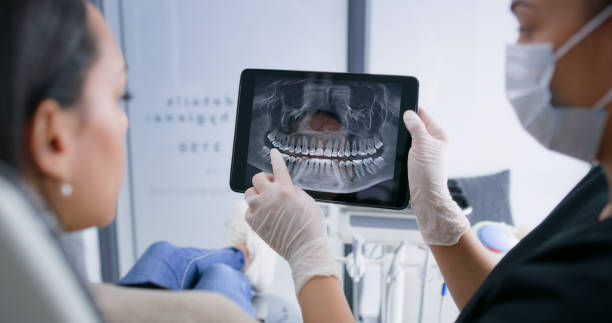 Licensed Wisdom Tooth Removal service in Shenandoah, LA - Smile Center Dentistry